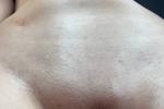 oil body