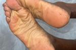 🦶🏼
