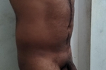 My hairy figure