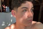 jaccob