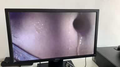 belly button
