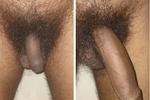 Soft vs Hard