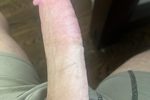 Me
