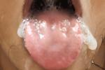 Mouth