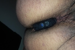 Anal
