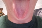 0
