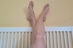 Legs and feet