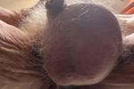 My balls