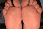 Feet