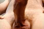 Dick