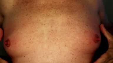 nipples