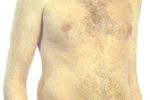 fap 006