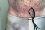 Leaking