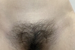 Hairy Pussy