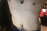Body