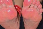 allyson๐ธ๐ฆ โ feets show now 4u๐ฃ