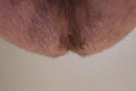 Backside