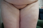 My belly