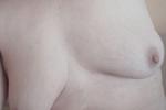 Topless