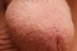 Dick Pics II