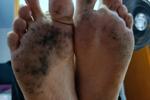 dirty feet master
