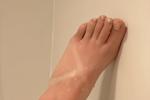 Sumburnt feet