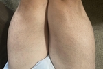Legs