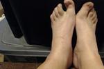 my feet