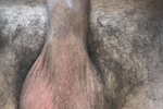 Bursting balls