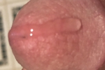 Leaky