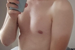 Teaser