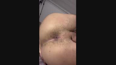 hairy ass