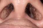 nose hole
