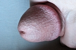 my tip close up
