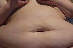 Belly