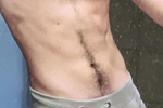 Body Pics
