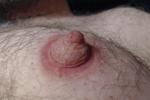 Nipple