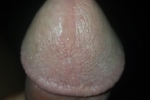Pre Cum
