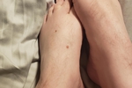 Feet