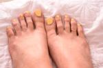 toe ring