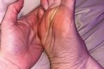 feet