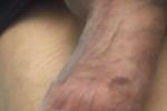 half soft dick