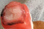 Ice