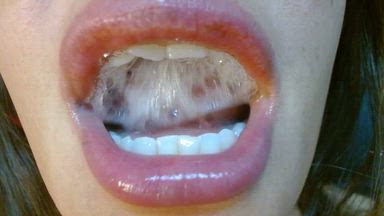 very wet mouth