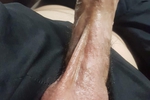 COCK