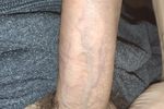 dick 1