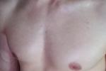FACE AND MUSCLES