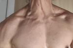 WOW Veins