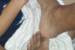 pedicure feet🤴🏾