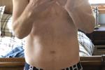 body